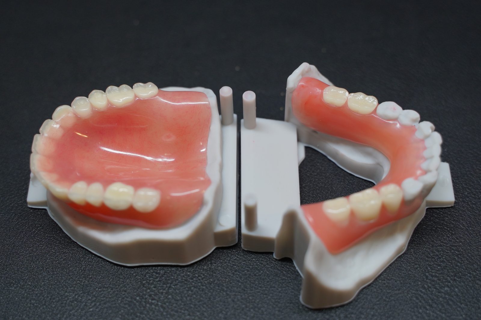 Complete upper denture and lower partial denture on models