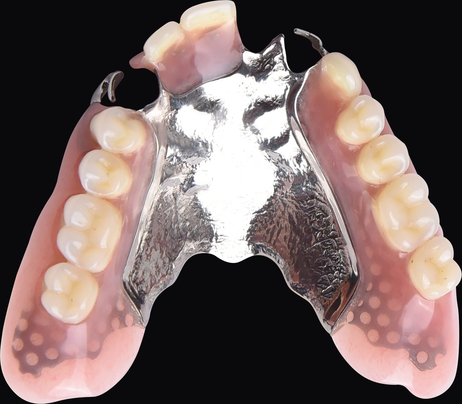Finished upper partial denture with polished metal base framework